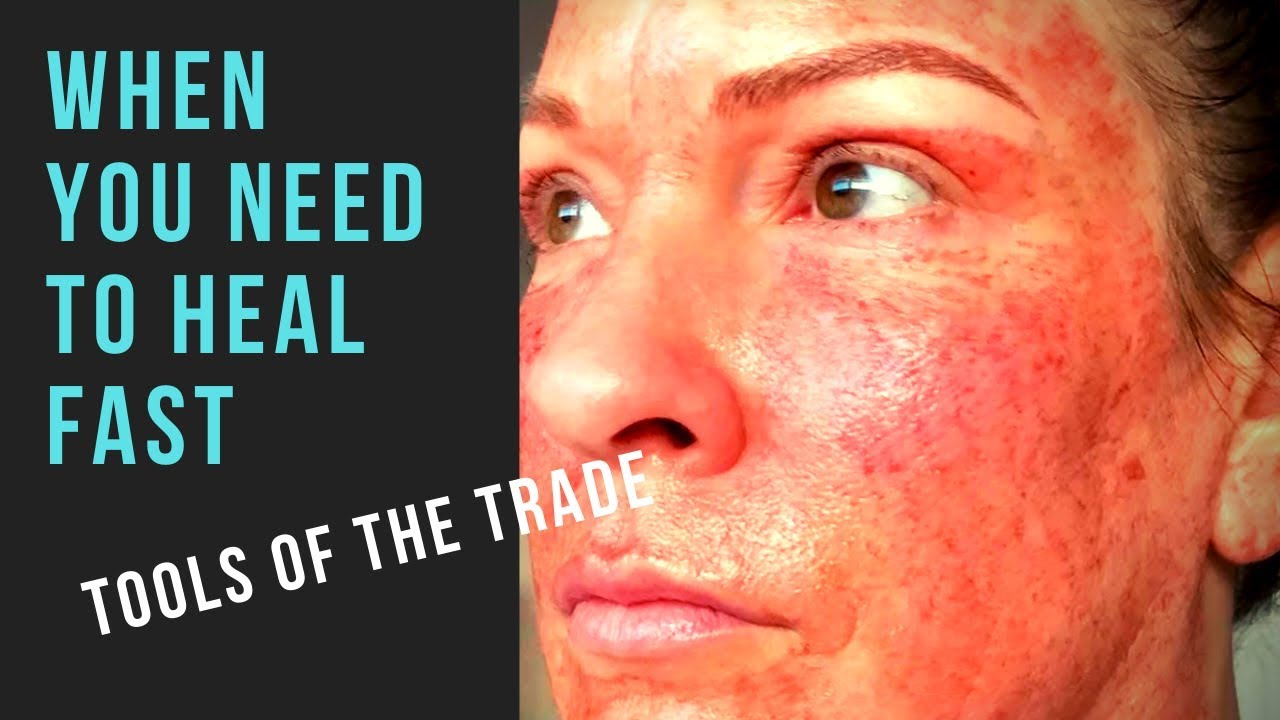 FULL FACE FIBROBLAST HEALING