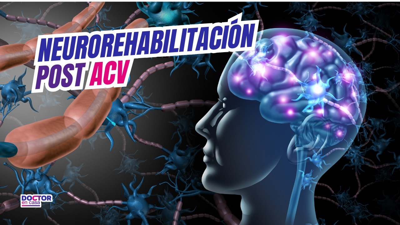 Neurorehabilitación post ACV