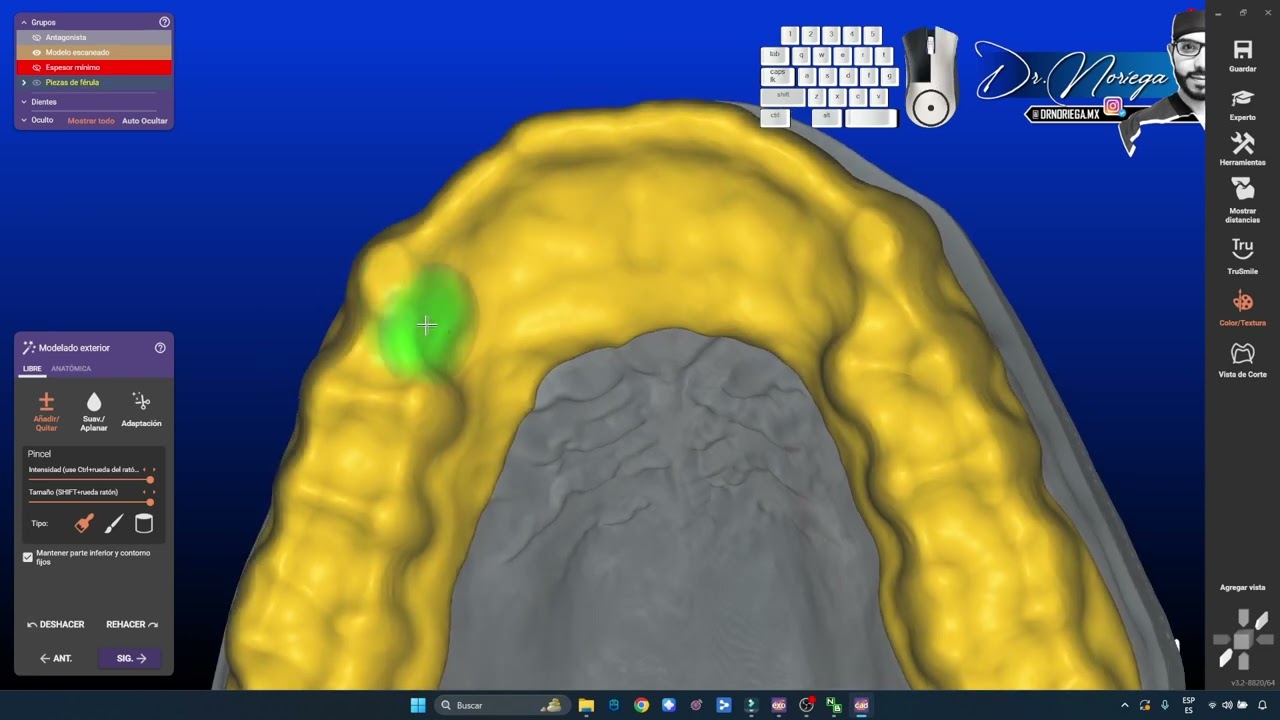 EXOCAD 3.2 ¬ GUARDA OCLUSAL / FERULA DE DESCARGA [ Diseño Digital ] DR. NORIEGA