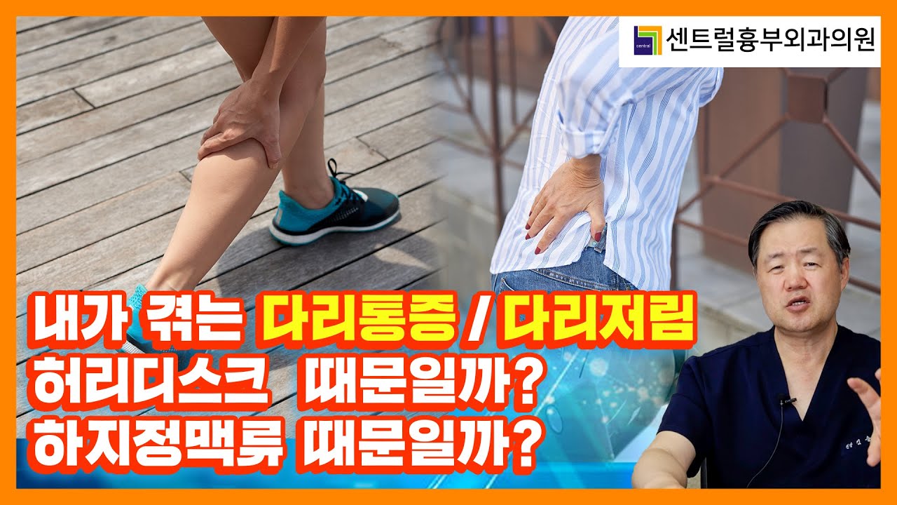 종아리통증(저림)의 원인, 허리디스크일까? 하지정맥류일까?