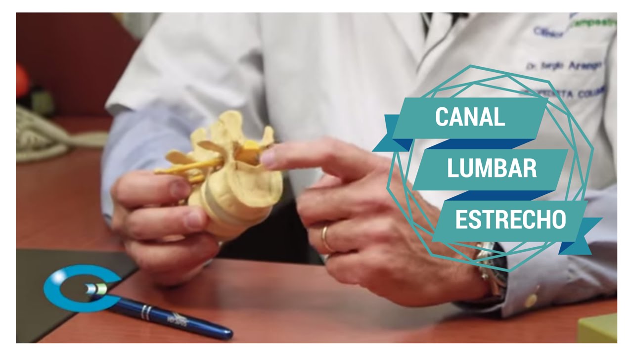 Canal Lumbar Estrecho