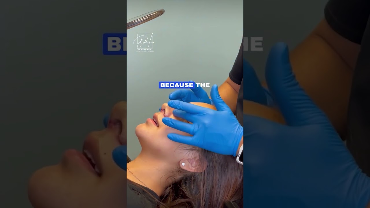 Nasal Massages after Rhinoplasty Surgery #shorts #rhinoplastysurgeon #rhinoplastyrecovery