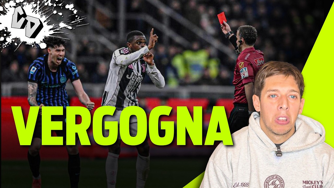 VERGOGNA