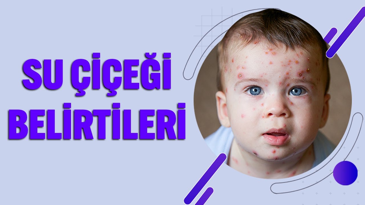Su Çiçeği Hakkında Bilmeniz Gereken Her Şey
