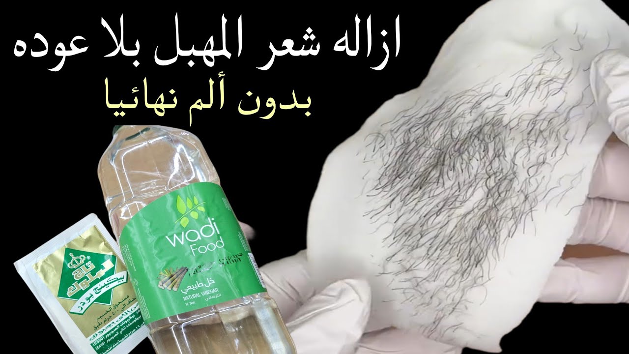 الخل والبيكينج بودر هتتخلصي من الشعر الزائد من الجذور وبدون الم وانسي الطرق التقلديه