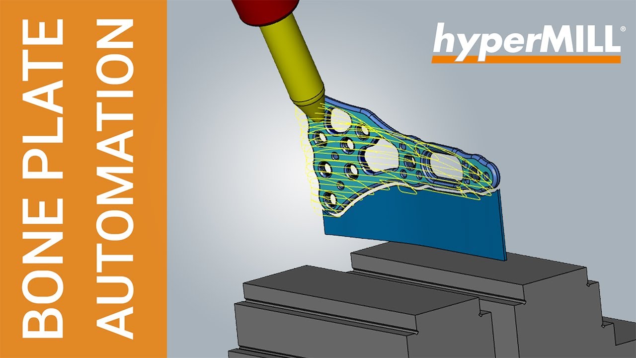 hyperMILL AUTOMATION CENTER: Bone Plate CAD/CAM Automation Use Case