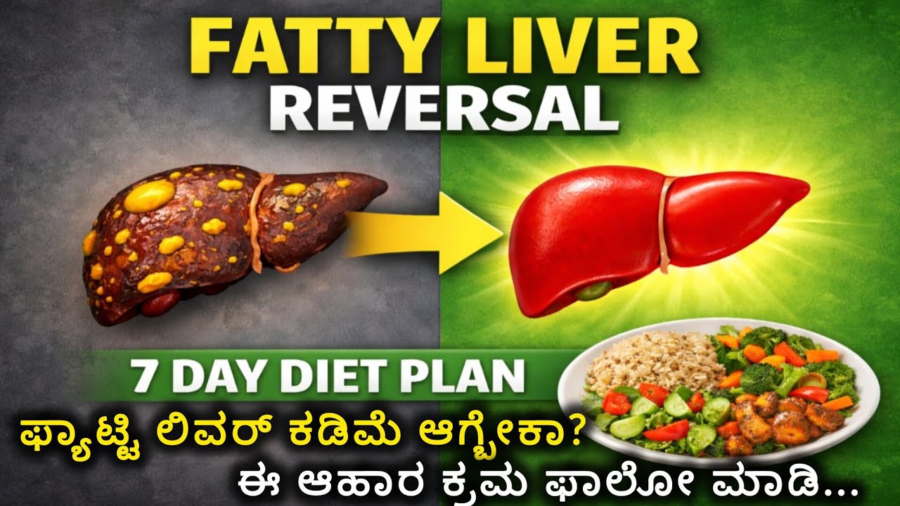 🧬 ಫ್ಯಾಟ್ಟಿ ಲಿವರ್ ಬೇಗ ಕಡಿಮೆ ಆಗ್ಬೇಕು ಅಂದ್ರೆ ಈ ತರ ಡಯಟ್ ಮಾಡಿ Fatty Liver Reversal Diet Plan #fattyliver 