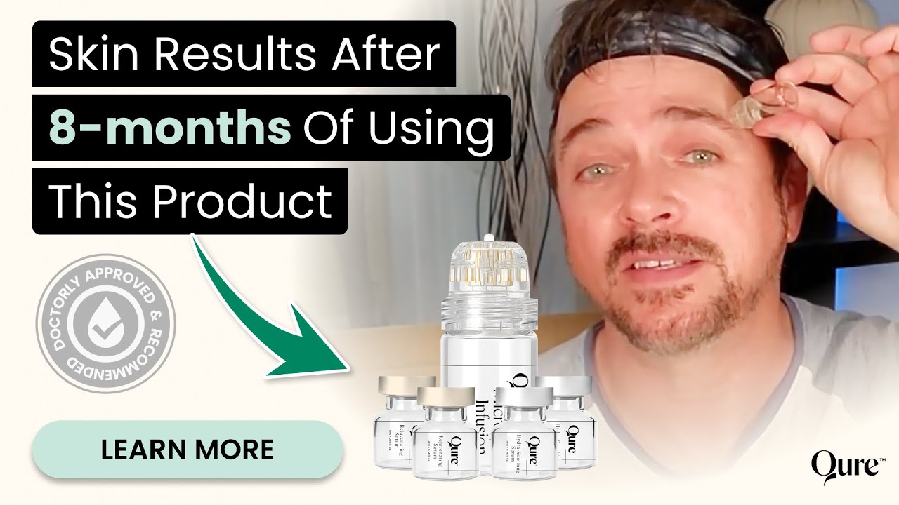 Skincare Expert Trades In Expensive In-Clinic Micro-needling Treatments For This At-Home Device