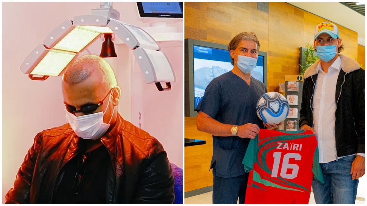 جواد الزيري زراعة الشعر في تركيا |  لاعب المنتخب المغربي مع Dr.Serkan Aygin الاول أوروبيا