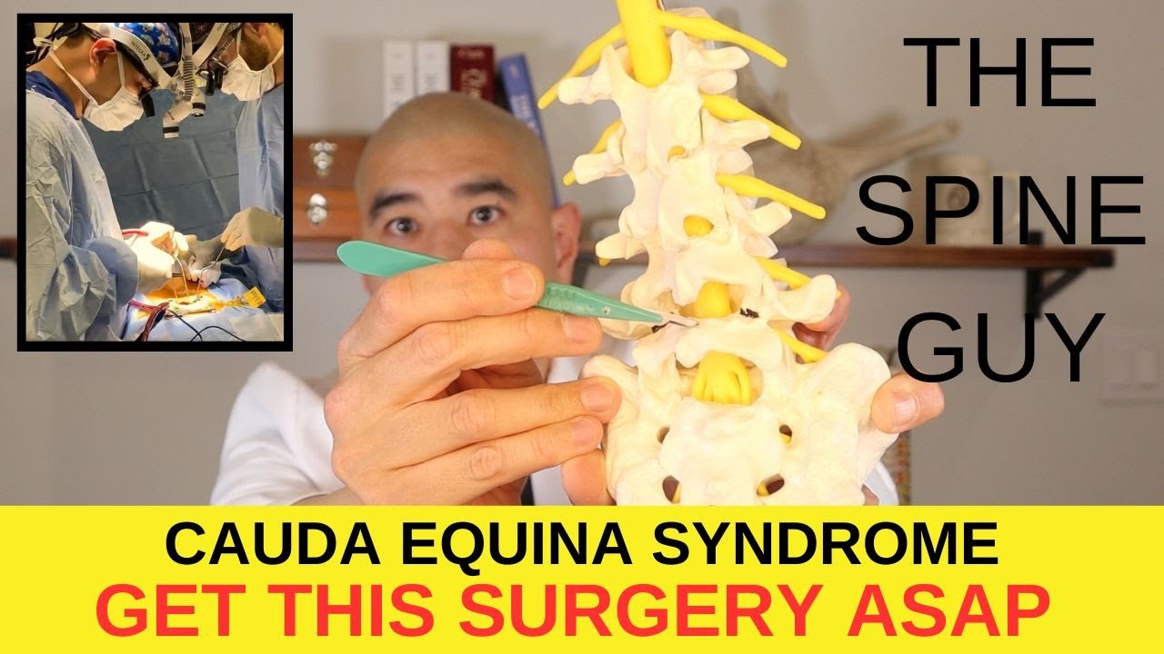 Surgical Treatment for Cauda Equina Syndrome