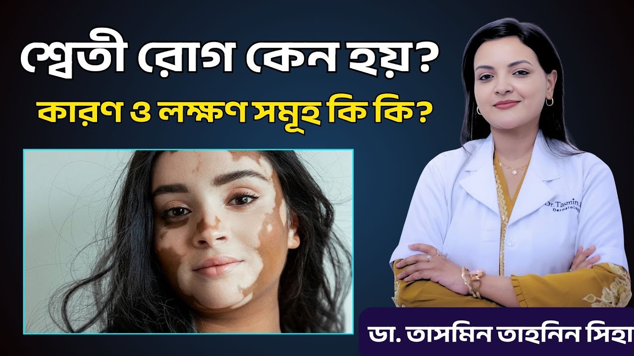 শ্বেতী রোগ কেন হয়? এর কারণ ও লক্ষণ সমূহ কি কি? | Dr. Tasmin Tahnin Siha। Vitiligo Diease