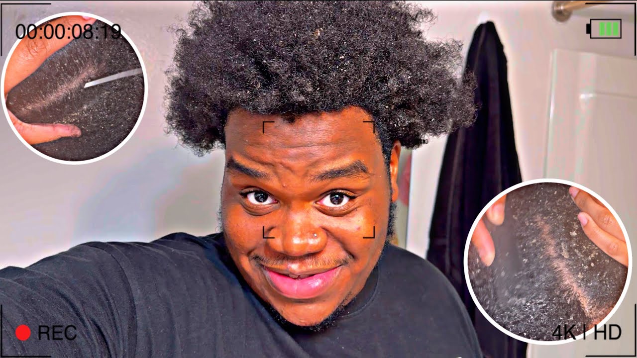 ‼️WATCH MY GIRLFRIEND SCRAPE MY DANDRUFF OUT MY SCALP ‼️ *VERY SATISFYING* 🎄ll VLOGMAS DAY 8 & 9 ll
