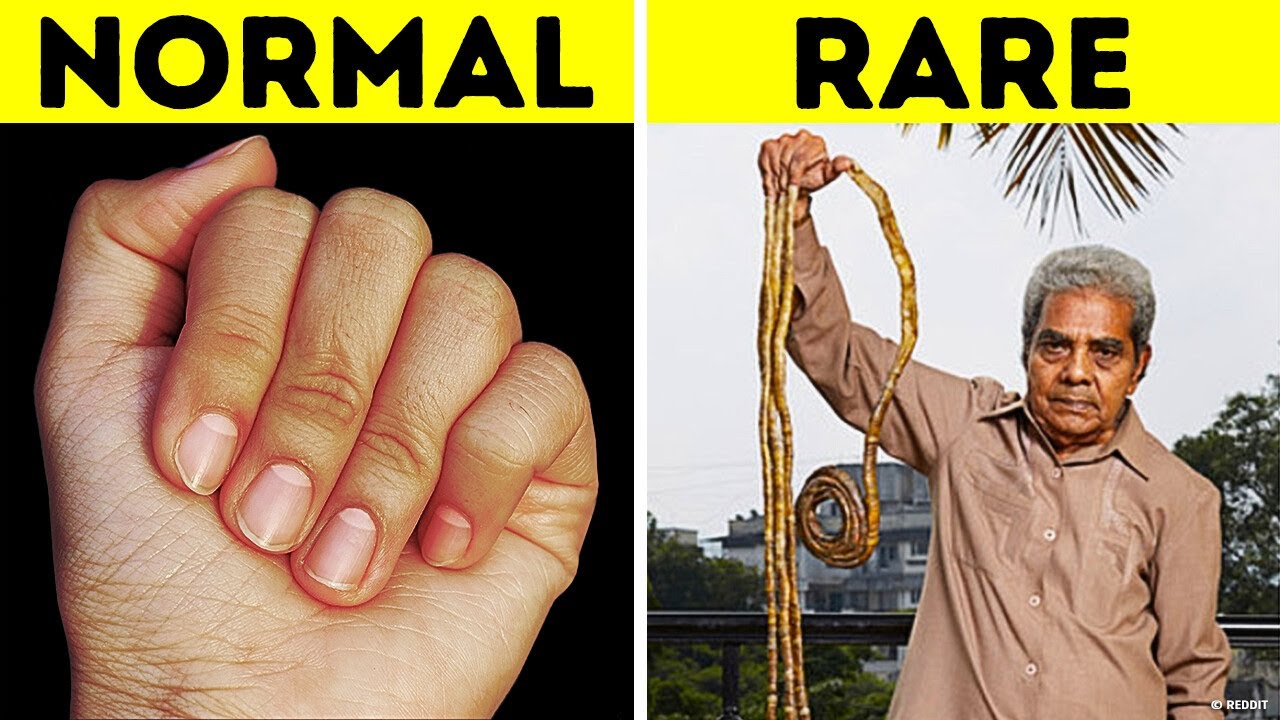 If You Wondered Why Your Body Does That, Now You Know