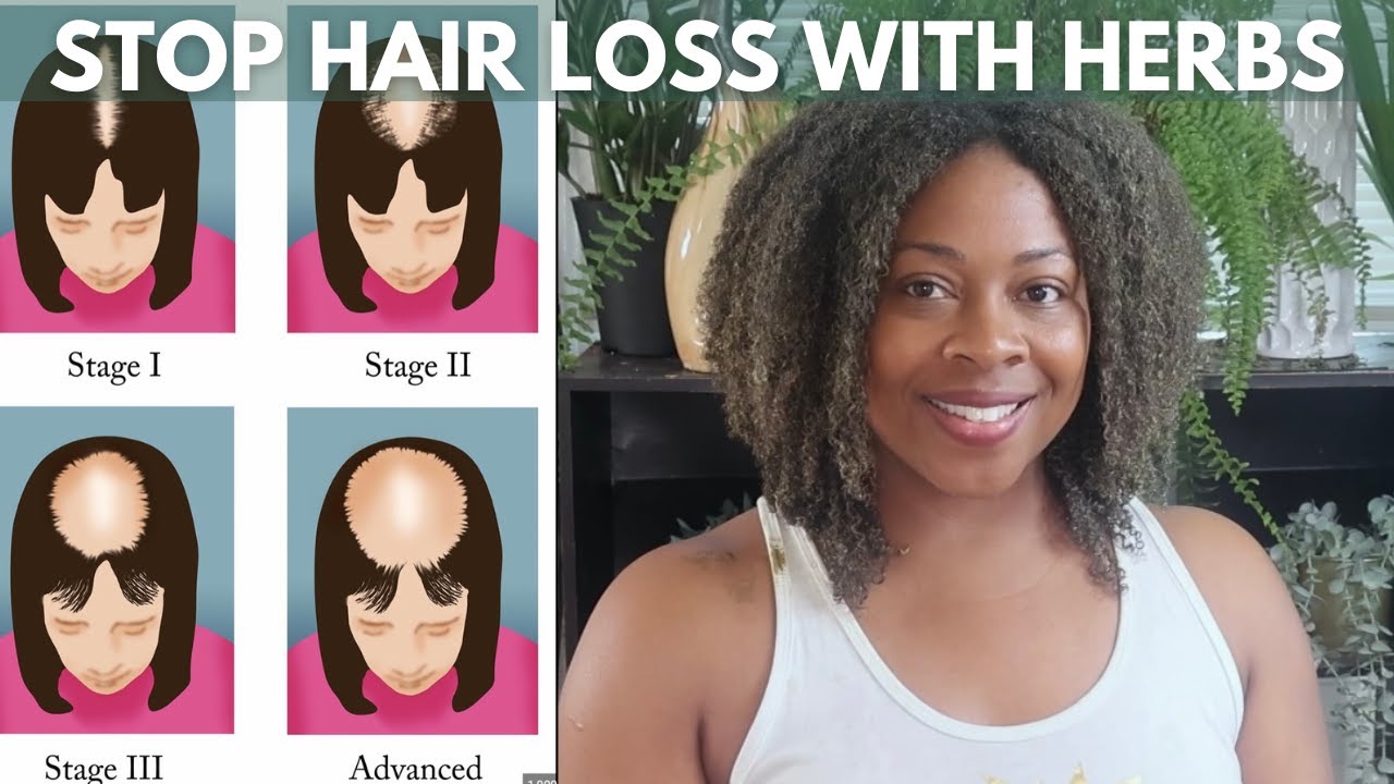 These Herbs Fight Hair Loss and Block DHT| Ayurvedic Hair Challenge Week 7