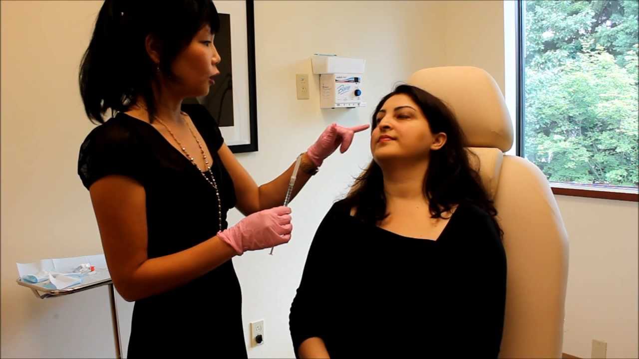 Fixing Deep Dark Circles Under the Eyes,Using Dermal Fillers and Cannula Injection