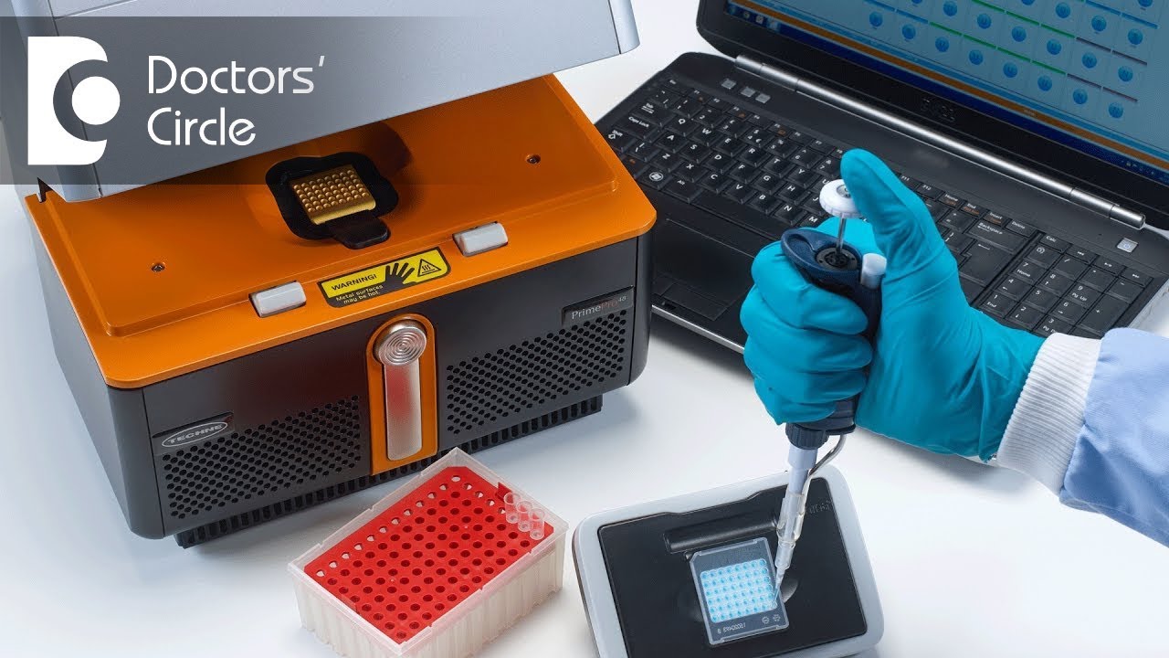 Is PCR test required to rule out HIV after negative ELISA & 4th gen. test? - Dr. Ramakrishna Prasad
