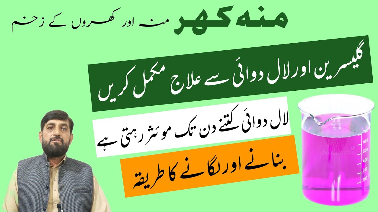 FMD منہ کھر Mein Pinki Aur Glycerine Ko استعمال karnay Ka 100% کامیاب Tarika | Muh Khur Treatment
