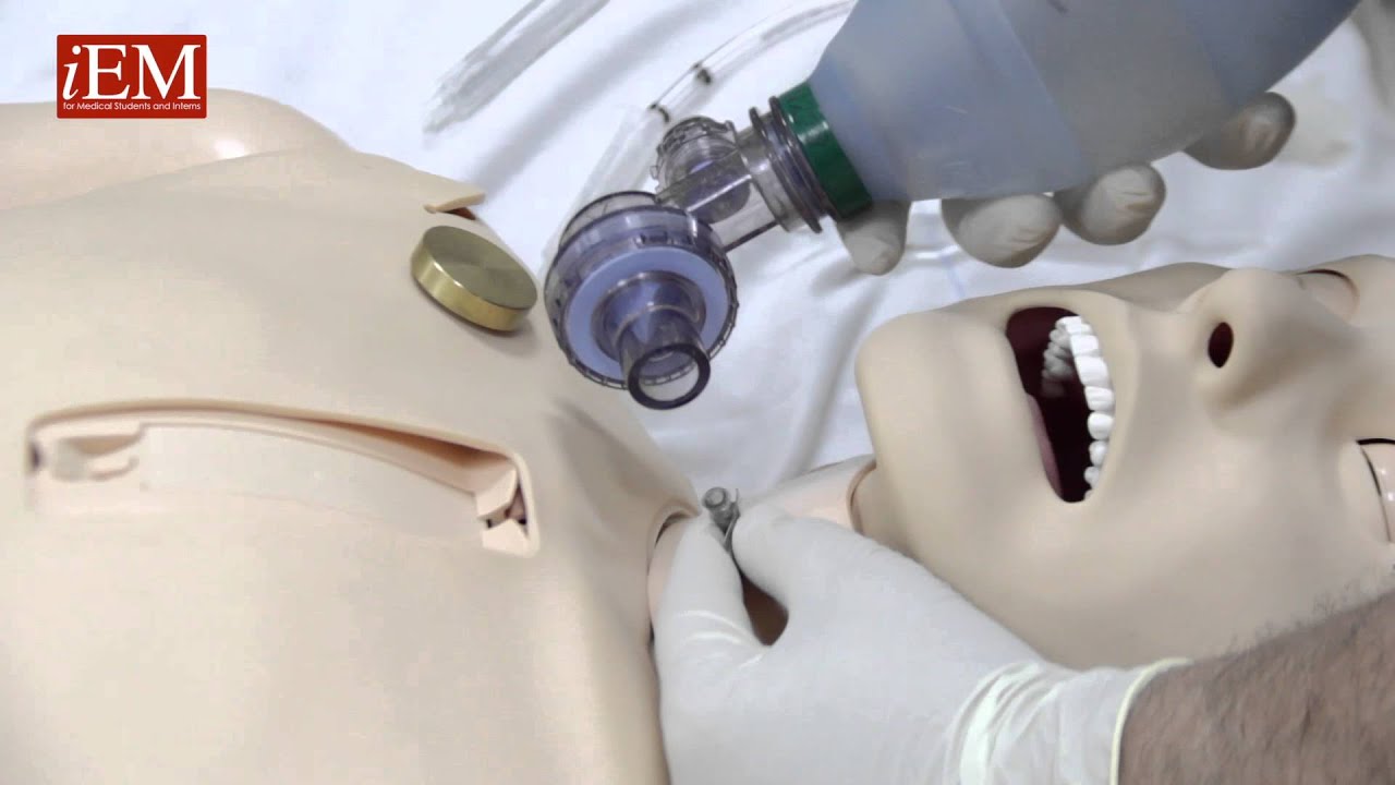 Simple Needle Cricothyroidotomy Options