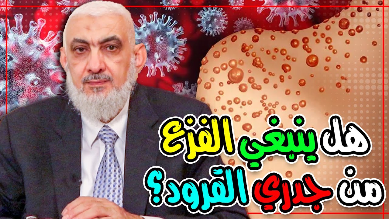 هل ينبغي الفزع من جدري القرود؟