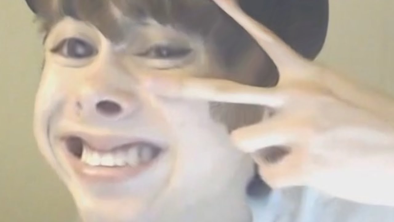 HELP ME FIND LEAFYS CHIN! #NoChin