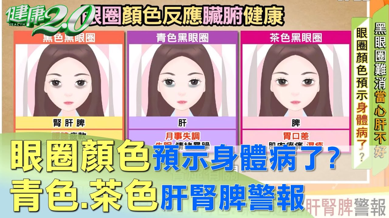 黑眼圈不只是黑色！ 青色.茶色透露肝腎脾警報 健康2.0