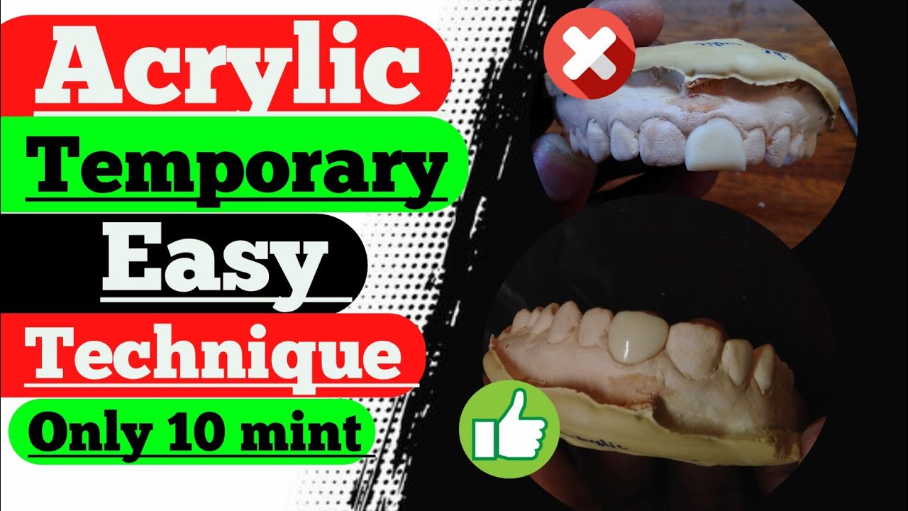 How to make temporary|Dental Lab | temporary work| Acrylic jc| Temporary finishing polishing| India