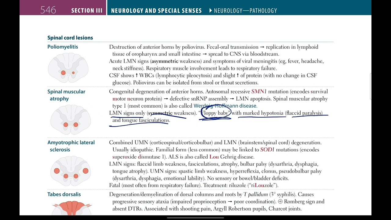 Spinal cord lesions made easy | Neurology # 18 | First Aid USMLE in Urdu/Hindi