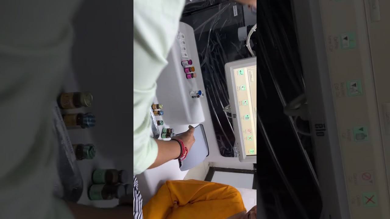 VITROS 5600 CALIBRATION 2