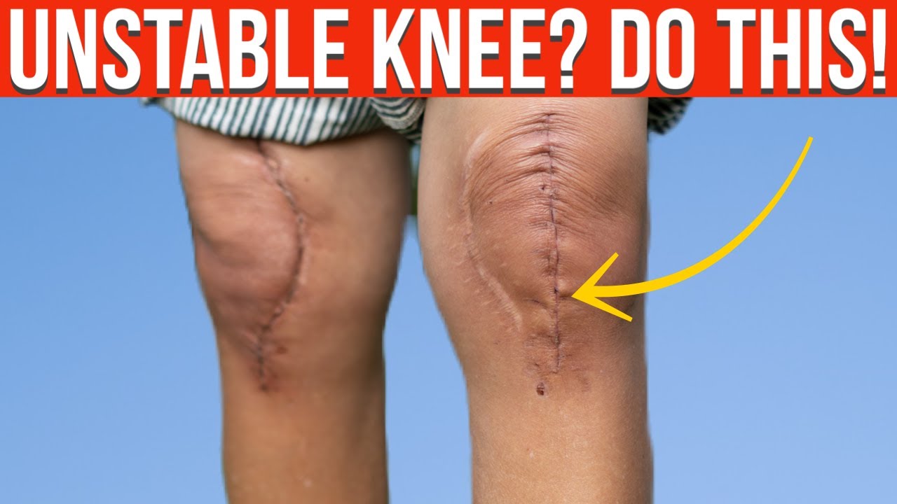 How to Improve Strength & Flexibility After 2 Weeks from Knee Replacement