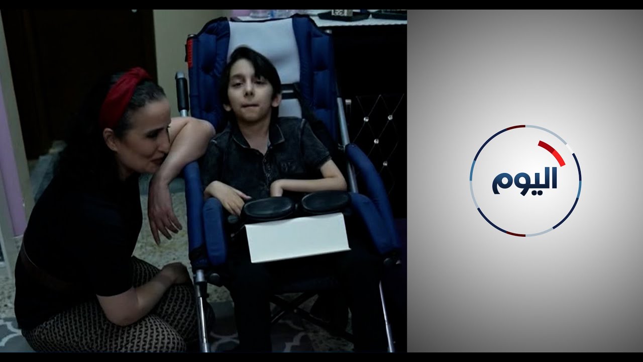 الأمراض الجينية والوراثية تشكل معاناة للأطفال وذويهم