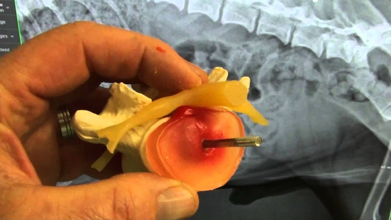 Dog Can't Walk :Herniated Disc