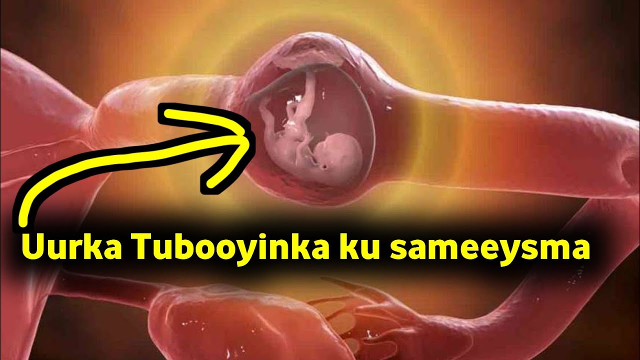 uurka ku sameeysma banaanka makaanka iyo dhiiga baxa xiliga uurka xiriirka ka dhaxeeyo Dr zamzam