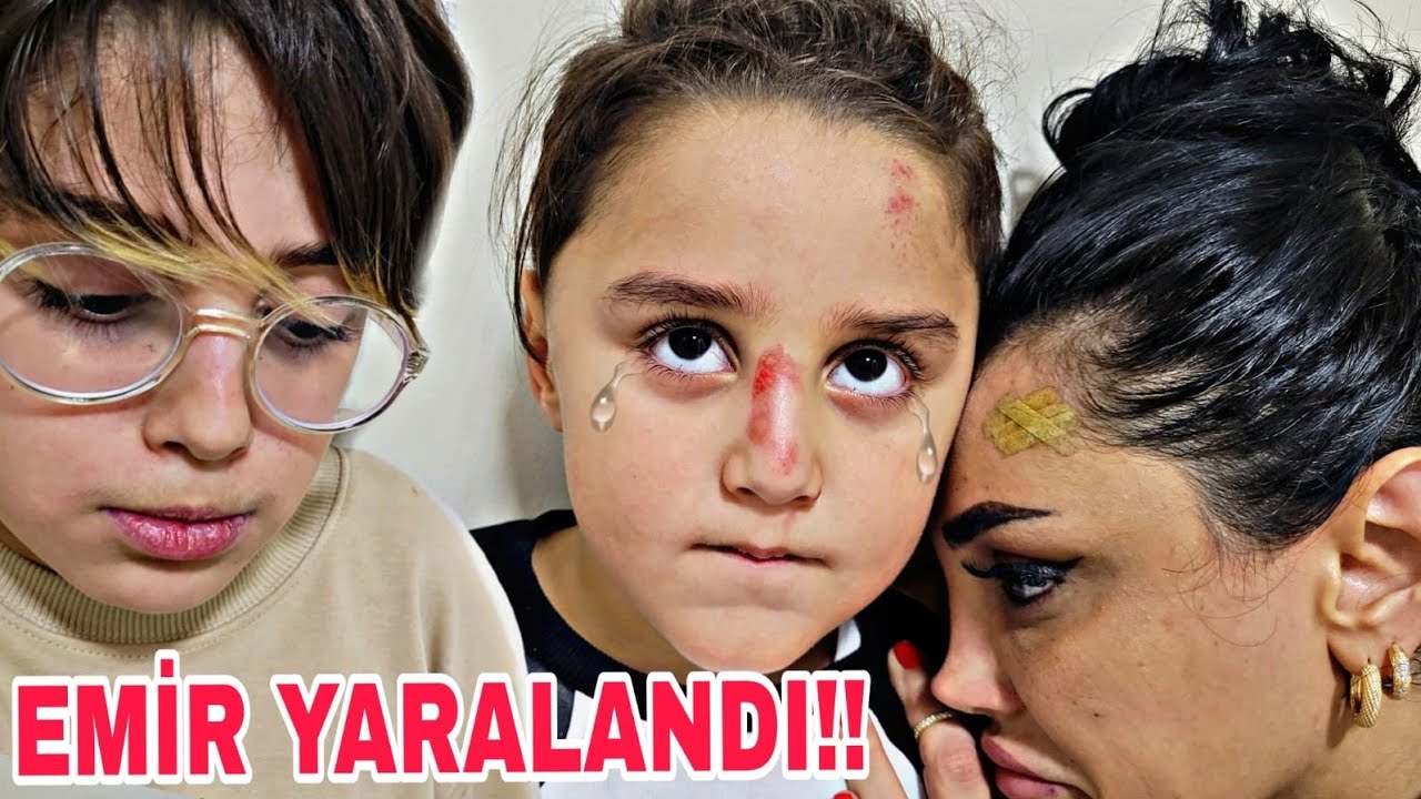 EMİR KAZA GECİRDİ !!