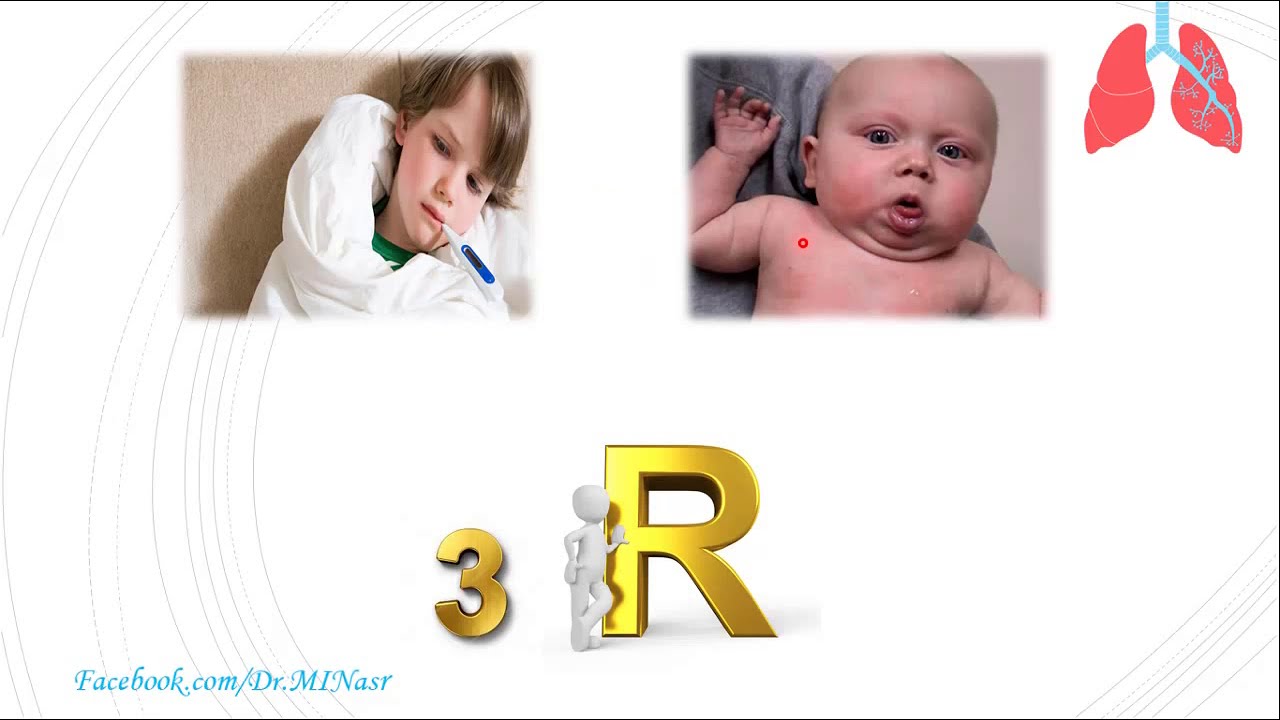 عملي الأطفال | Clinical Pediatrics 7 | Chest