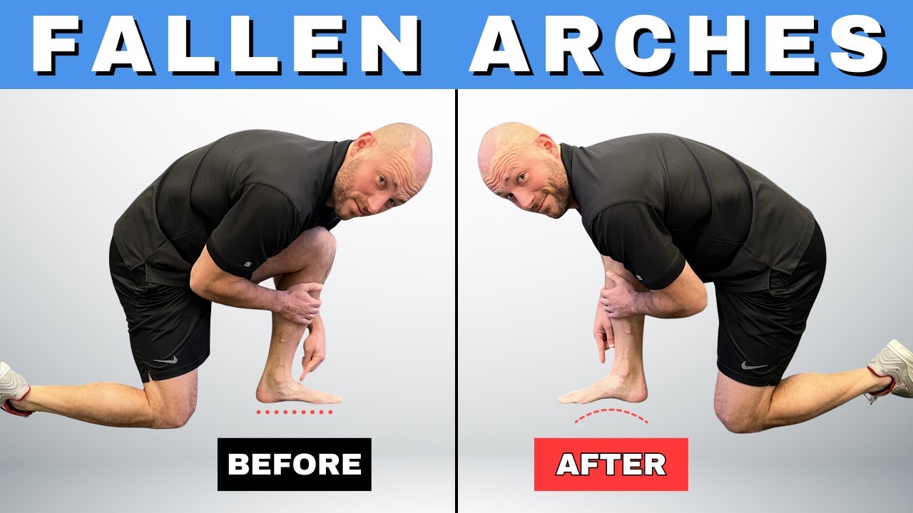 Rebuild the Fallen Arches on Your Feet with 3 Simple Tips