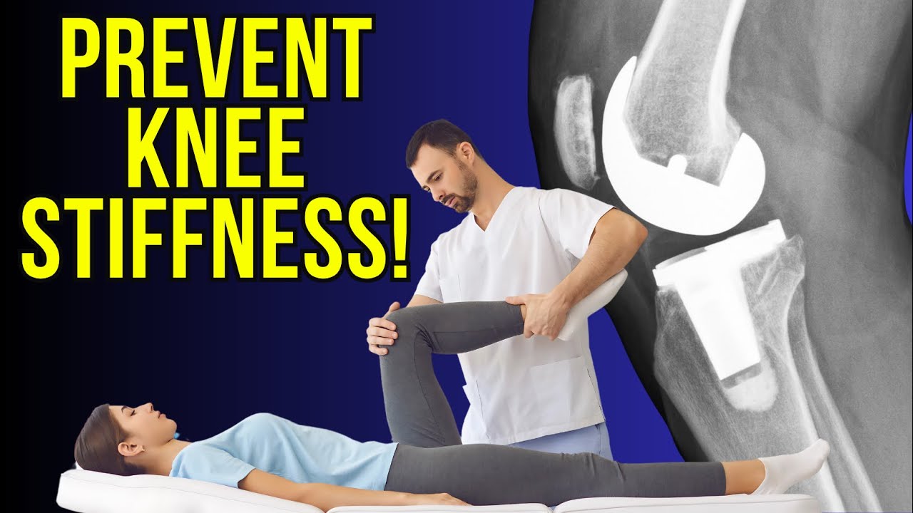 How to Avoid Stiffness After Total Knee Replacement | What You Need to Know