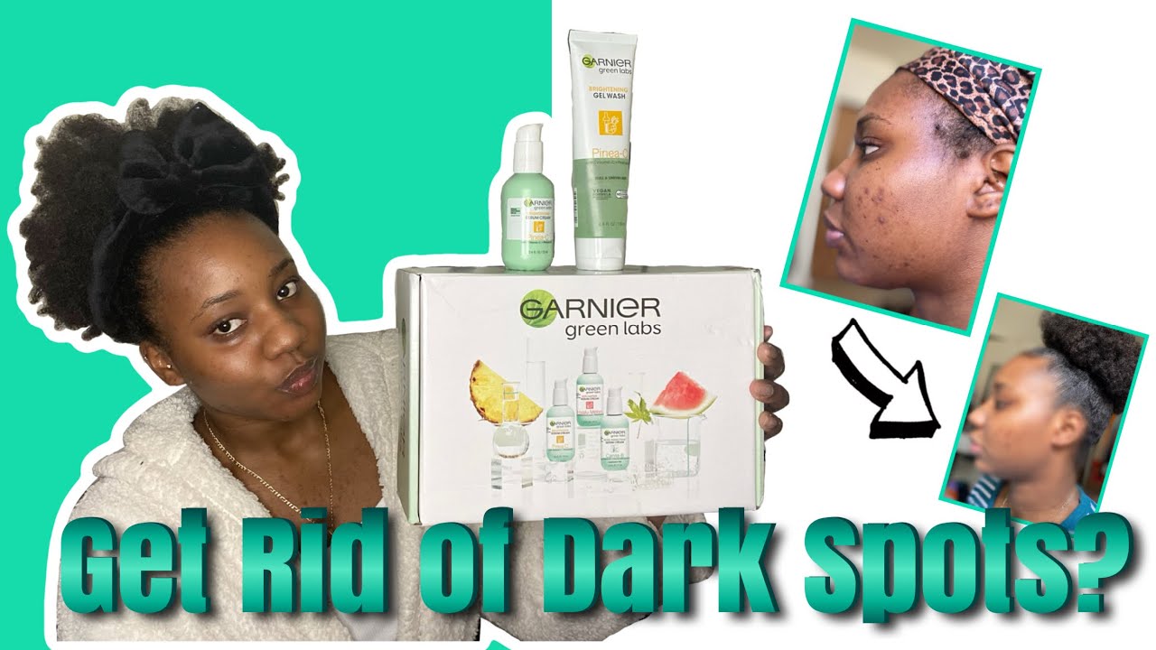 Garnier Green Labs Review | Fade Dark Spots