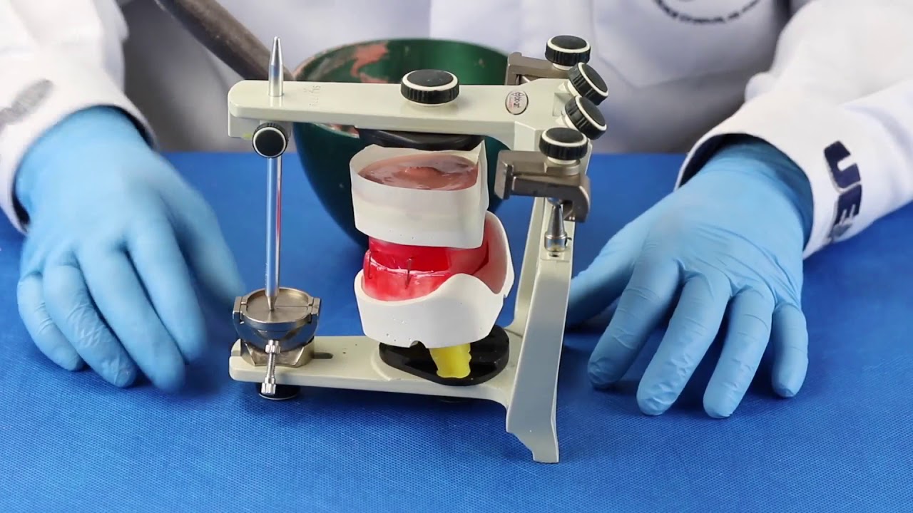 Montagem dos modelos funcionais em Articulador Semi Ajustável