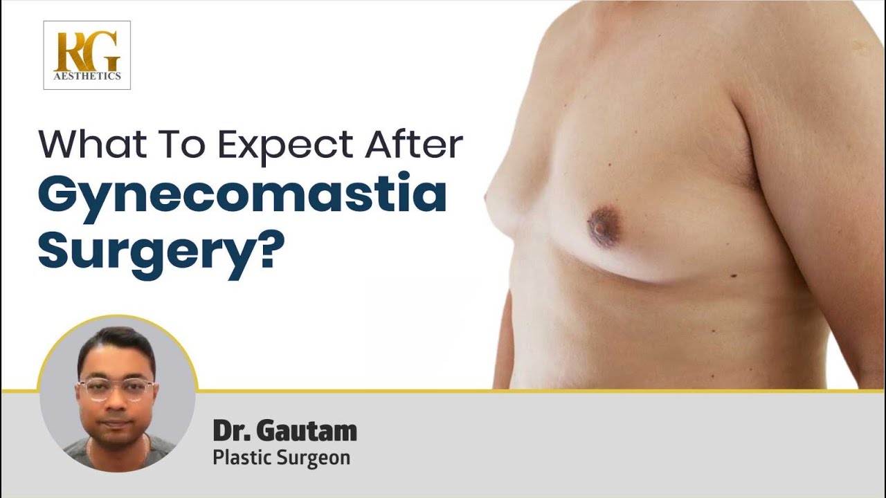 What to Expect After Gynecomastia Surgery? गाइनेकोमेस्टिया सर्जरी के बाद क्या अपेक्षा करें-Dr Gautam