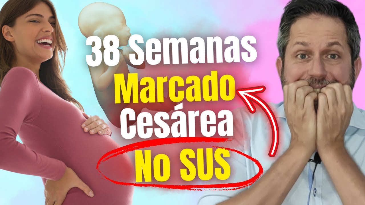 Principais Queixas das 38 semanas de Gestação é Marcado Parto Cesárea no SUS em 2025