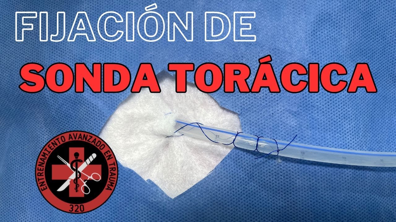 Nudo para fijación de sonda de toracostomía