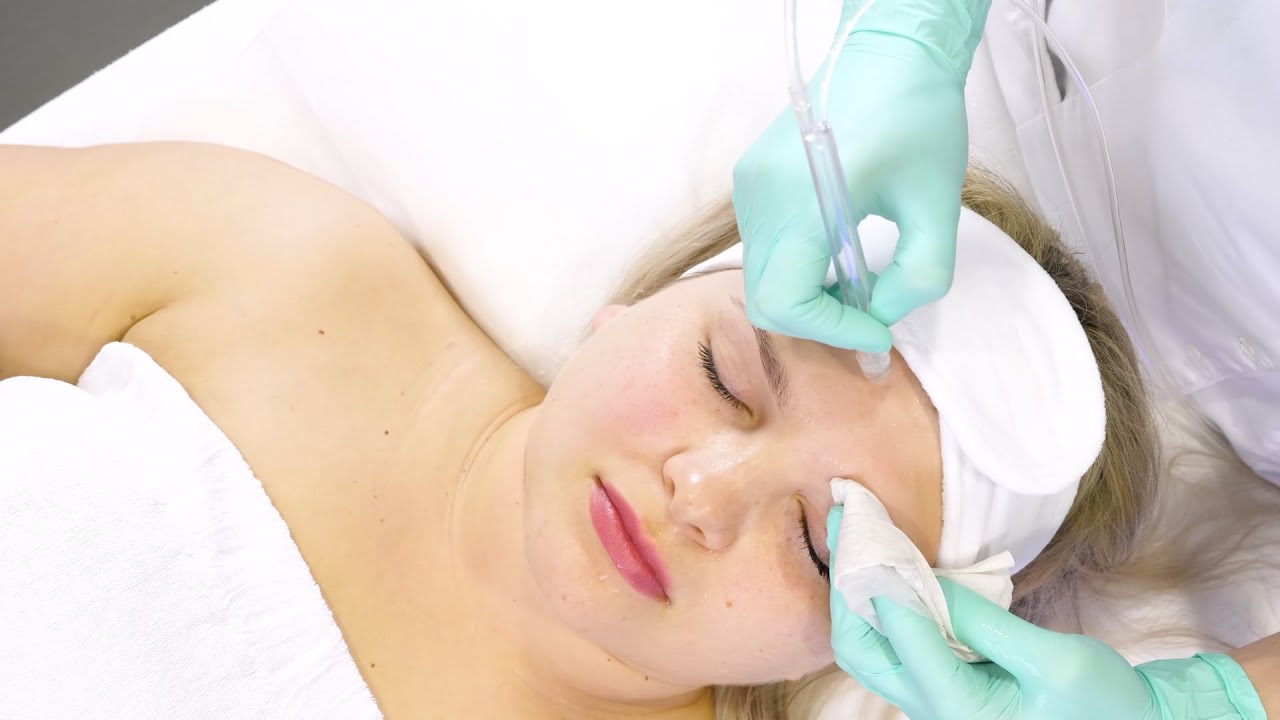 Oxybrazja (oksybrazja) Body Care Clinic Katowice