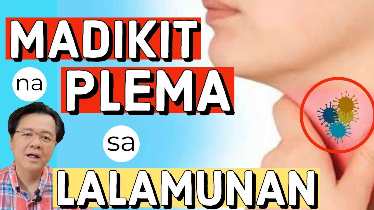 Madikit na Plema sa Lalamunan: Alisin Ito - Payo ni Doc Willie Ong