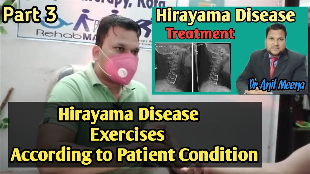 hirayama disease treatment and exercises | hirayama disease exercises | hirayama Exercise |in hindi