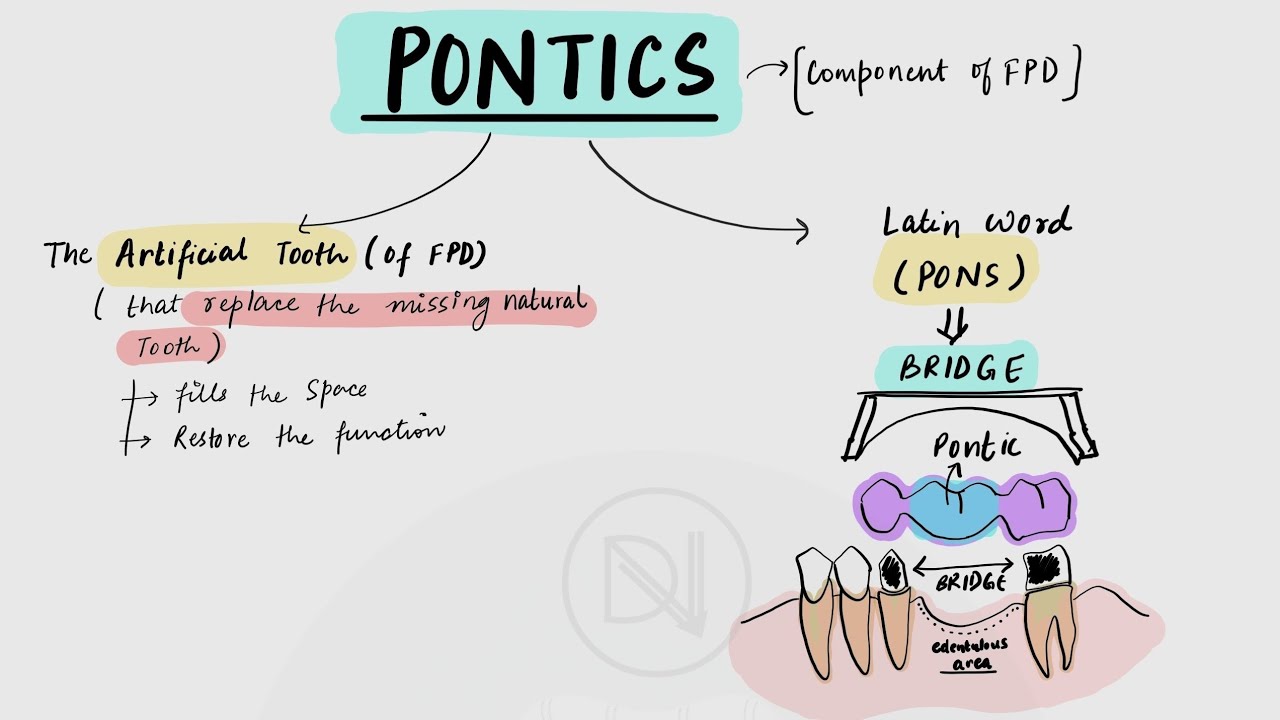Pontic