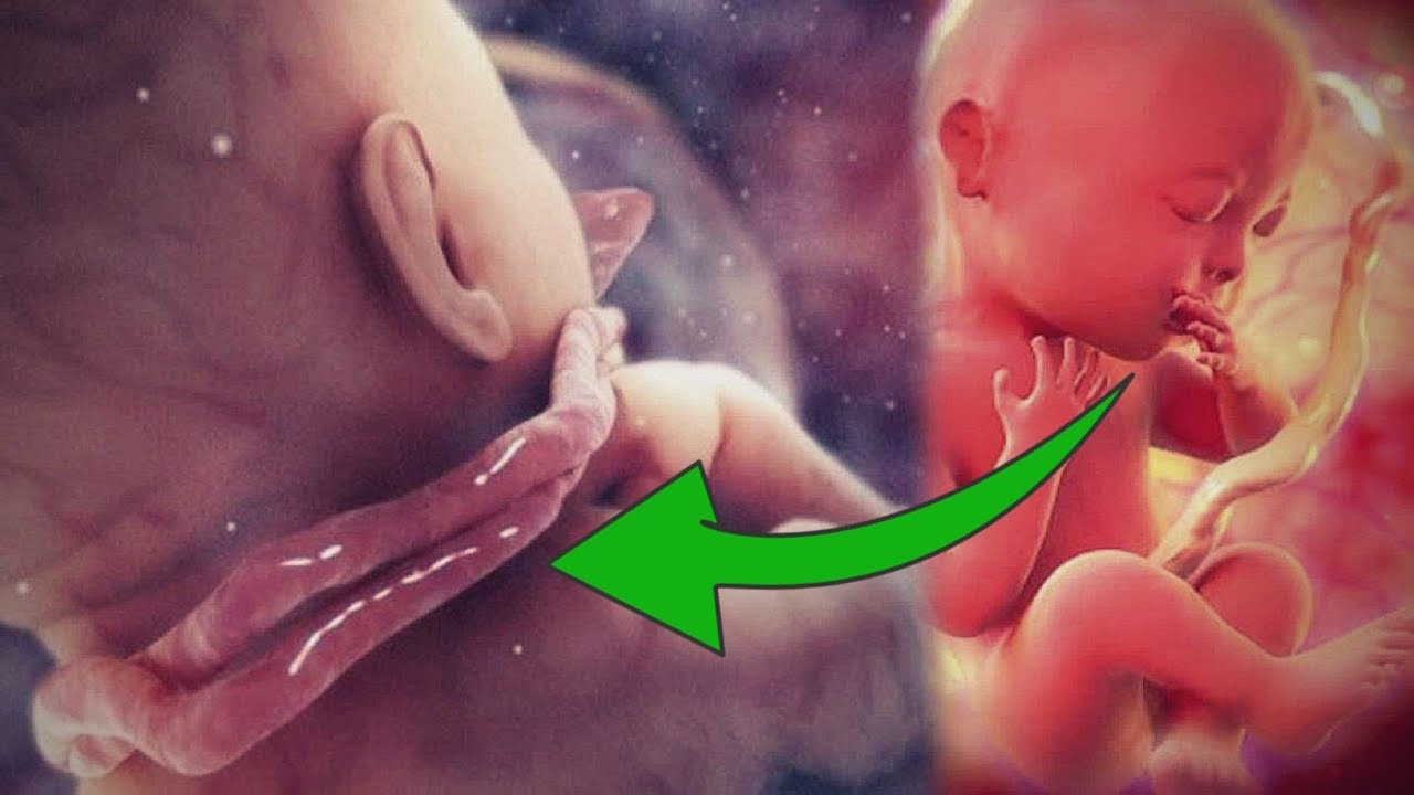 Göbək Ciyəsi Uşağın Boynuna Dolanarsa... - Bu Zamanv TƏHLÜKƏLİDİR