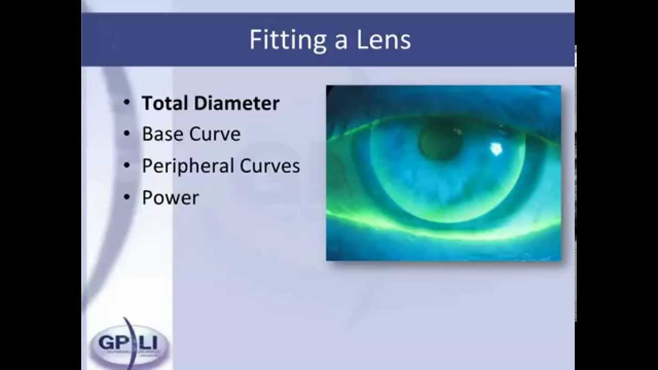 Fitting Keratoconus