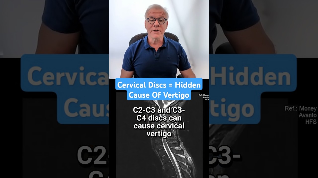 What Causes Cervical Vertigo a Deep Dive into Upper Neck Discs