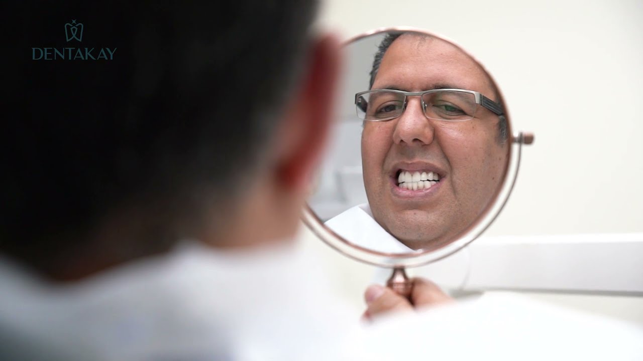 Amjad de France a fait son sourire hollywoodien en Turquie | le résultat est incroyable