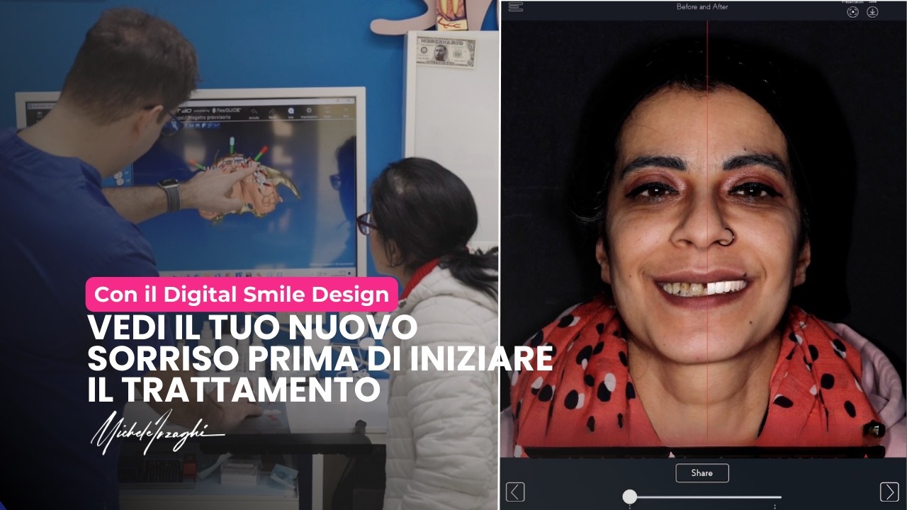 Digital Smile Design: cos’è e come vedere il nuovo sorriso prima del trattamento